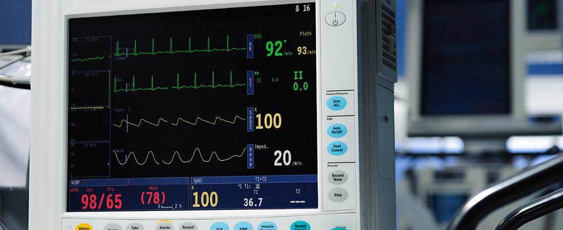 Anesthesia Monitors